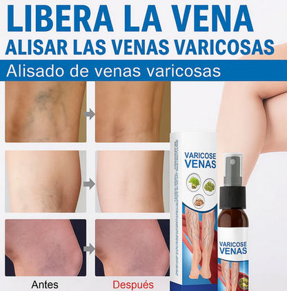 Spray Varices Patch Ald
