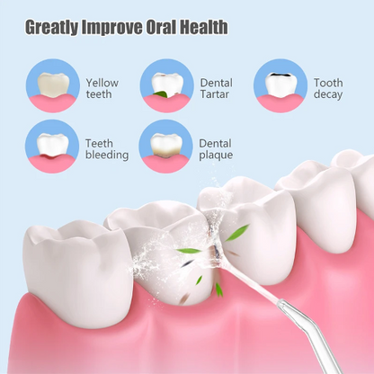 Irrigador Dental Limpieza Oral Recargable